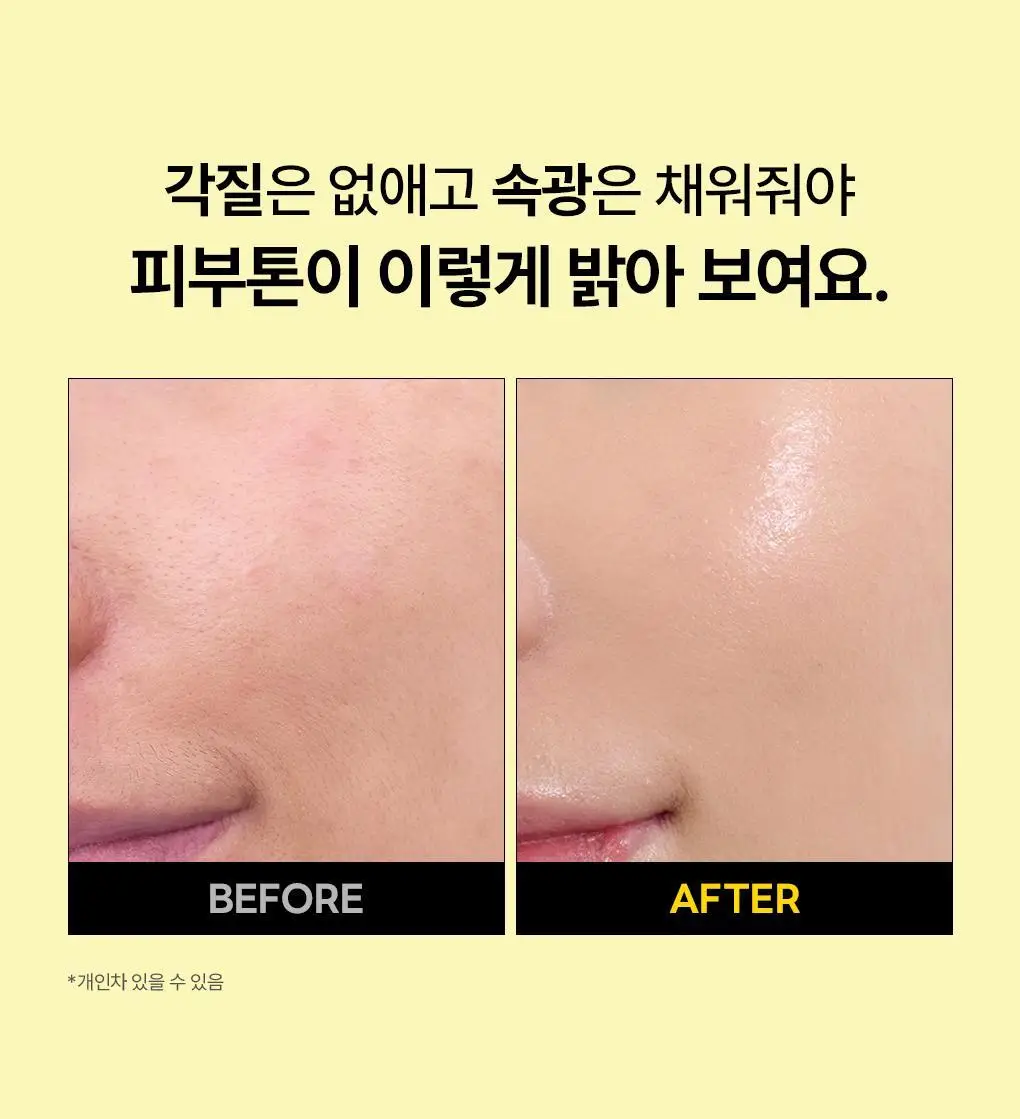 [장도연 PICK/1+1] 메디힐 비타민씨 브라이트닝 세럼 40+40ml 더블 기획 상세페이지 3